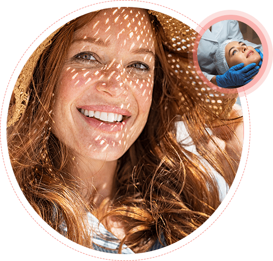 A woman with red hair and freckles on her face.